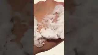 Короткие юбки и шорты открывают все неровности кожи - "апельсиновую корочку"