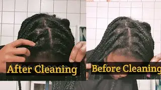 How to Clean Your Scalp in Braids Without Washing - Cleaning my Braids Using Apple Cider Vinegar