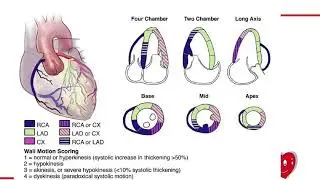 L’Ecocolordoppler cardiaco