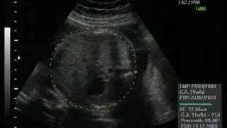 US 3D Parte I