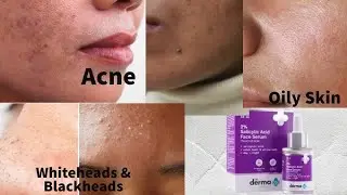 Dr derma Salicylic Acid review|Dr derma|Geniune Review#onlineshopping #Review#skincare 