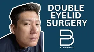 Pros and Cons ng Double Eyelid Surgery: Kailangan Mo Malaman