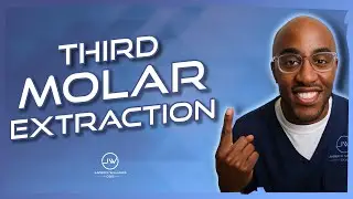 Surgical Extraction 3rd Molar #32