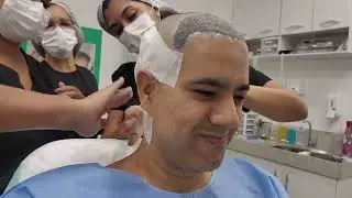 Depoimento Real! - Transplante Capilar no Grupo Gamallo