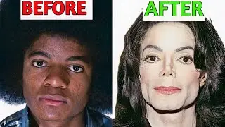 The Evolution Of Michael Jackson&rsquo;s Face | Plastic Surgery Analysis
