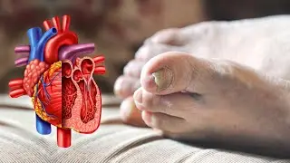 Why are your feet always cold and how to treat it | Public Health #94