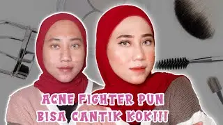 THE POWER OF MAKEUP!! ACNE FIGHTER!!!