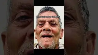 Before and after Dentures:A new Confidence!#dentist #denture #shorts  #delhidental #southdelhi #new