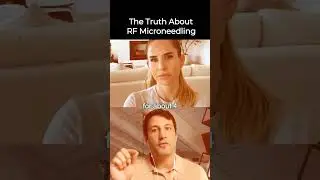 Radio Frequency Skin Tightening | Does (RF) Microneedling Get Results? #facialtreatment #reviews #vs