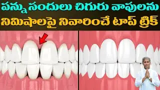 Teeth | పంటి సందులు చిగురు వాపులు నిమిషాల్లో తగ్గిచేస్తుంది | Dr Manthena Satyanarayana Raju