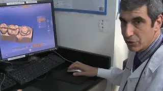 CAD:CAM Technology to Fix Teeth Faster and Better
