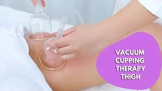 Vacuum Cupping Therapy | Slim Thighs & Legs | Lose Thigh Fat | PART 4 myChway 2183