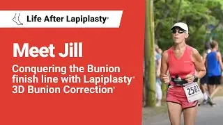Meet Jill | Conquering the Bunion finish line with Lapiplasty&reg; 3D Bunion Correction&reg;
