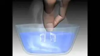 MegaVent nasal dilators - anti snoring nasal breathing aid