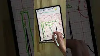 How To Interpret an EKG #learning #subscribeformore 