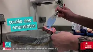 Laboratoire de prothèses dentaires à Boisseuil (87)