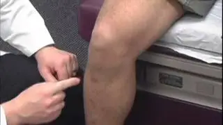 Introduction to Musculoskeletal Exam of the Knee
