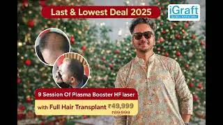 2025 Final Hair Transplant Offer   9 Plasma Booster HF Laser Free with your Full Hair Transplant