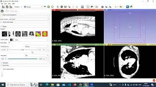 Lungs Segmentation - 3D Slicer