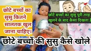छोटे बच्चो ( बेबी बॉय) का सुसु कैसे खोले।  How To open baby boy private part