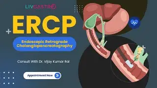 What is ERCP? A Simple Explanation by Dr. Vijay Kumar Rai
