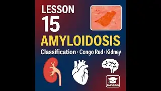 Lesson 15 &ndash; Amyloidosis | Classification, Organs, Congo Red Stain I MBBS/BHMS/FMGE  (CBDC Pathology)