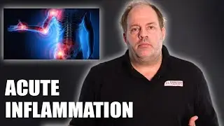 Treating Acute Inflammation Naturally