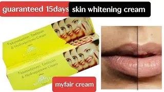 my fair cream review in Tamil  #skincare #skinwhitening