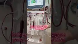 Mesin Hemodialisa Baru untuk Pejuang Gagal Ginjal