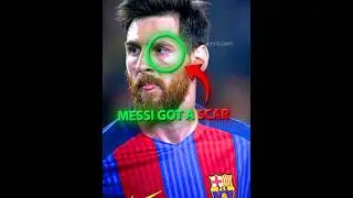 Messi's Scar Changed Everything ❤️&zwj;🩹