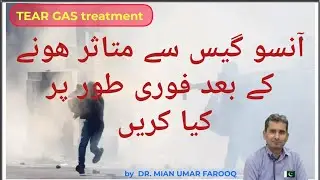 Tear Gas Treatment |آنسو گیس کا علاج|What is tear Gas|آنسوگیس کن اعضاکو متاثرکرتی ہے|@drumarfarooq