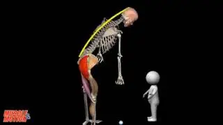 body material
