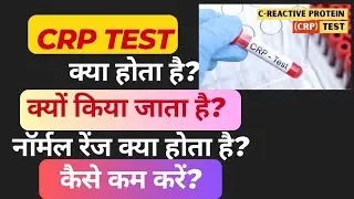 CRP test| C -Reactive Protein Test | CRP test in hindi 