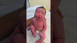 Never press the soft spot of a newborn baby #shorts