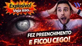 PREENCHIMENTO PODE CAUSAR CEGUEIRA? (ALERTA URGENTE)
