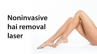 Noninvasive hair removal laser for long term reduction of face & body hair