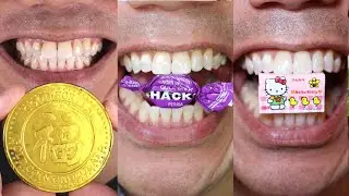 Satisfying Chewing ASMR #Compilation #ASMR #DoctorTristanPeh