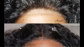 REDONNER VIE À SA LACE CLOSURE/FRONTAL| NE JETTE RIEN
