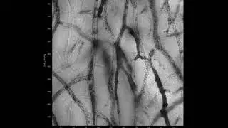 Cupid Paper 1 Movie 1: Cupid-GFP Phase images in Fungal hyphae