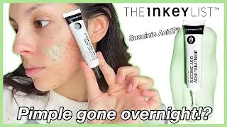 The Inkey List Succinic Acid | BEST Acne Spot Treatment?!