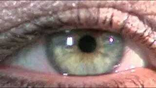 The Evolution of the Eye
