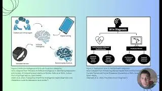 Personalized Treatment On Depression with AI-Assisting Technology