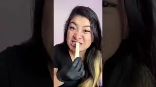 I lost my teeth