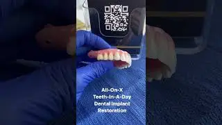 All On X : Teeth In A Day Dental Implant Restoration
