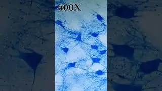 NEURONAS BAJO EL MICROSCOPIO🧠🔬