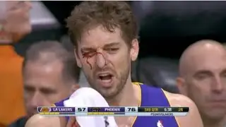 Nba Worst fights 2020 💀😱!!