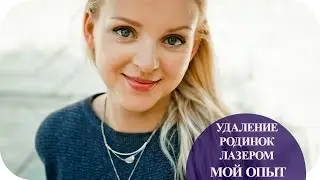 Удаление родинок лазером на лице и теле. Мой опыт. Греция (Mila MyWay)