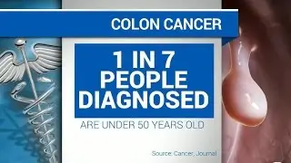 Colon cancer rising among people under 50