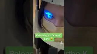 Releasing an ortho-K lens to a -5.00 myope! 😃 #orthokeratology #orthok #contactlenses #contactlens