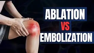 Genicular Artery Embolization vs Nerve Ablation | Which Works Better?